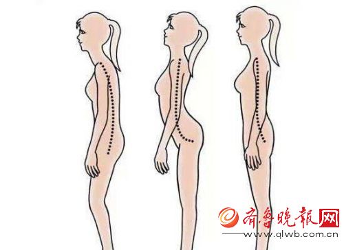杨幂颈部前倾 原来娜扎、陈伟霆都是她的病友