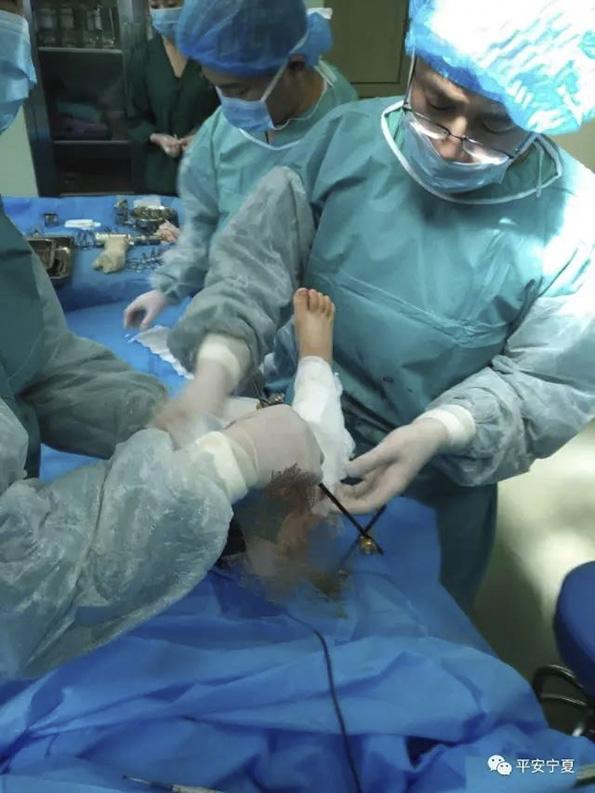 宁夏两岁半男孩被母亲砍断右腿 断肢已再植成
