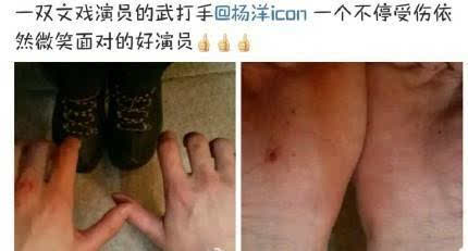 陈道明再讽小鲜肉 杨洋屡次受伤躺枪