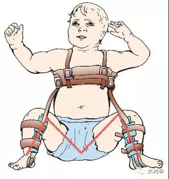 大J小D:要孩子健康成长 腰凳不能随便用 大J小D:要孩子健康成长 腰凳不能随便用