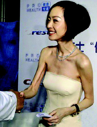减肥不要命的女星：大S晕倒袁洁莹患厌食症