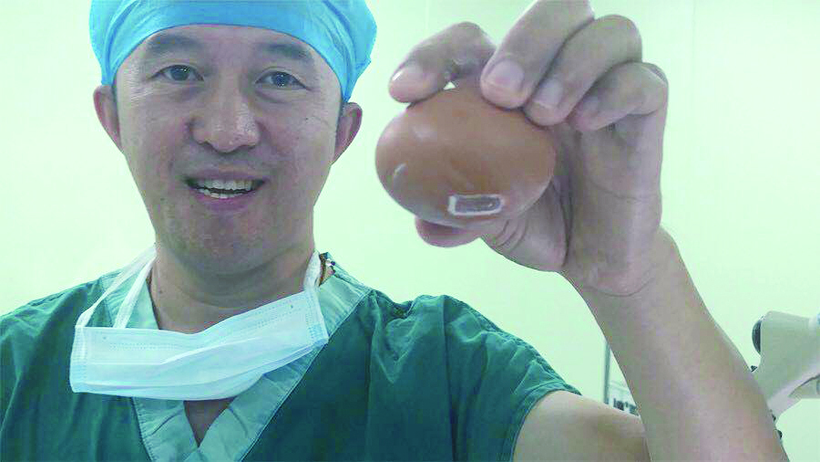 长春市中心医院外科医生秀绝技：为鸡蛋膜做缝合手术