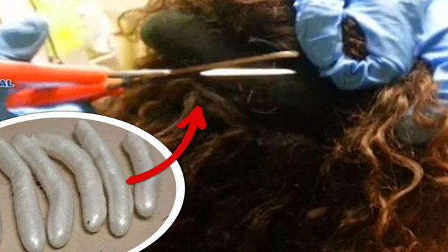 葡萄牙女子頭髮內藏毒880克 在西班牙機場被捕