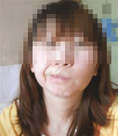 安徽女子赴韩国整形成"歪嘴" 为维权被关看守所
