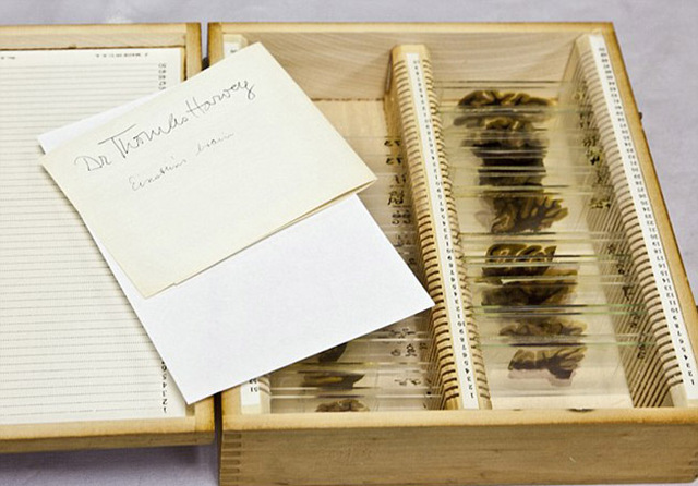 費城博物館獨家收藏愛因斯坦大腦切片 曾被秘密偷走
