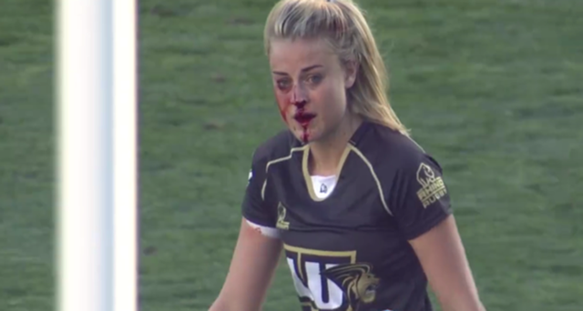 澳橄榄球女神赛场受伤 满脸鲜血继续奋战