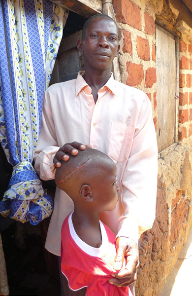 慘絕人寰！烏干達兒童遭閹割砍頭當作祭品