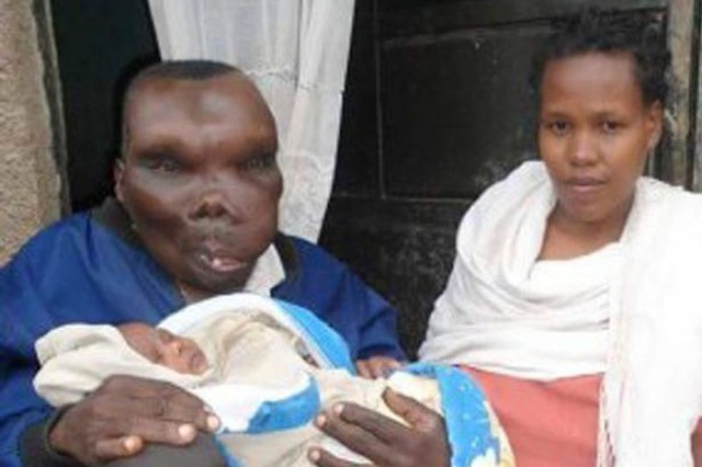 烏干達最醜男子“靠臉吃飯” 已生8個孩子
