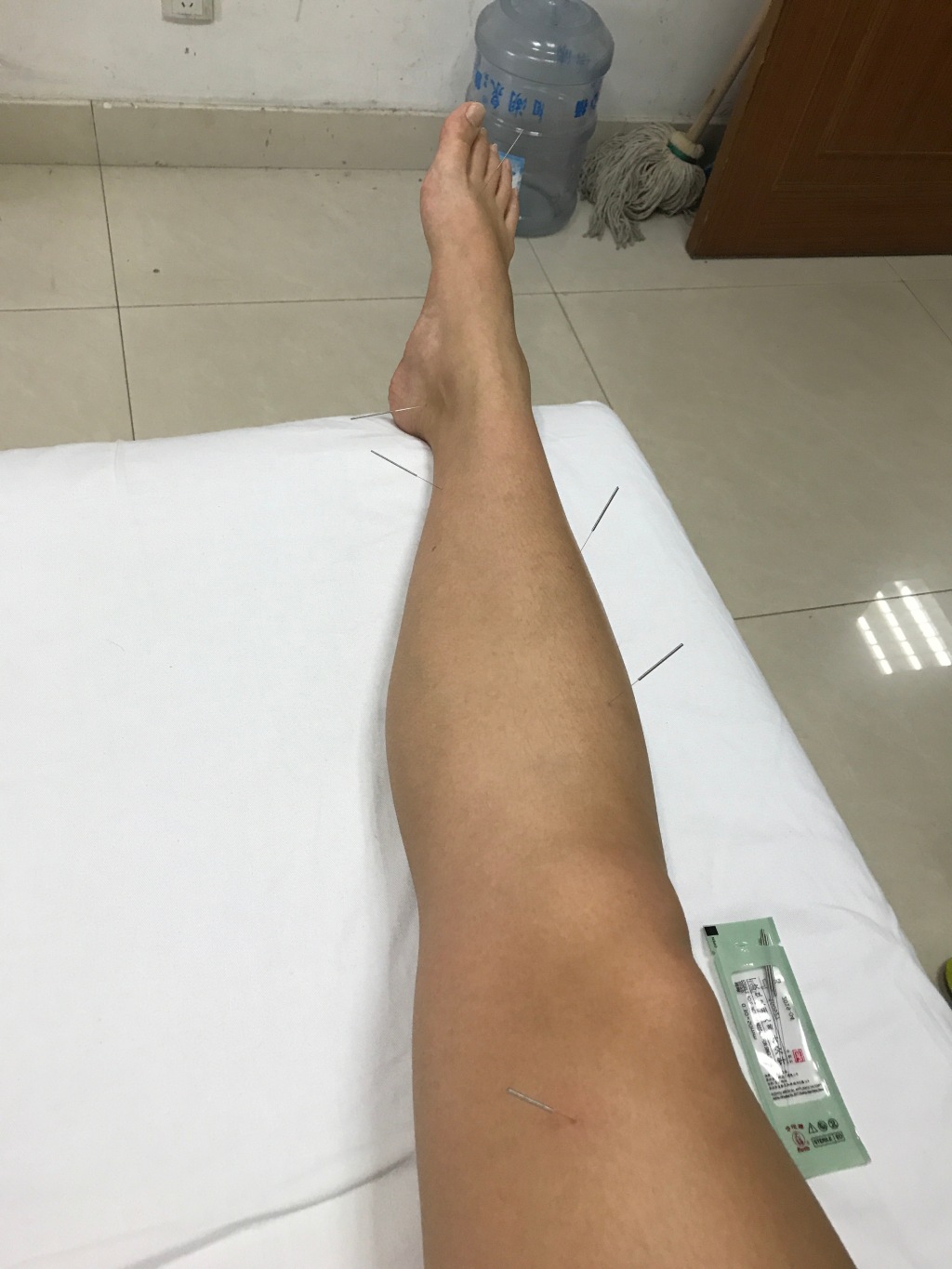 傅园慧扎针灸熏艾草治伤病