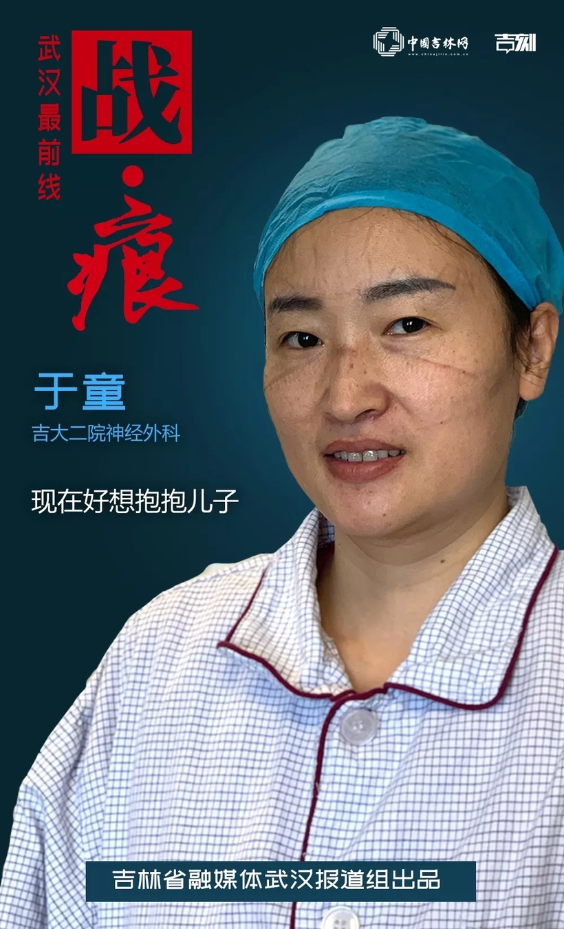 这道勒痕，是英雄最美的“勋章”！