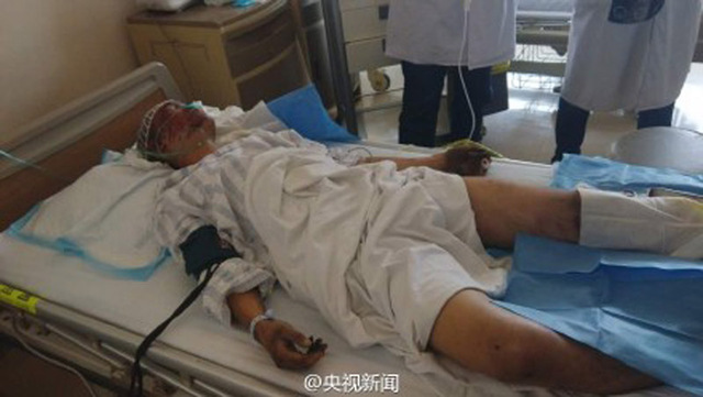 天津濱海倉庫爆炸現場：一名19歲消防戰士被救出