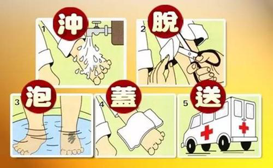【应急知识进万家 安全防护靠大家】烫伤正确的处理方法
