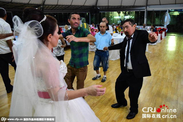土耳其第六例接受“换脸”手术患者结婚