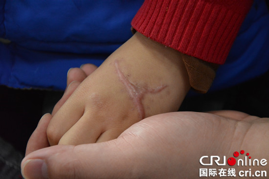 【CRI專稿 列表】國際兒童癌症日 重慶醫生呼籲加大對兒童腫瘤治療關注