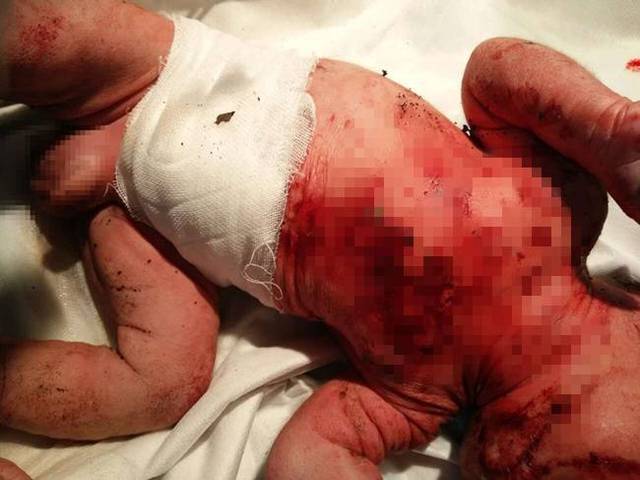 陕西15岁女孩产子 用竹签刺遍婴儿全身致其死亡