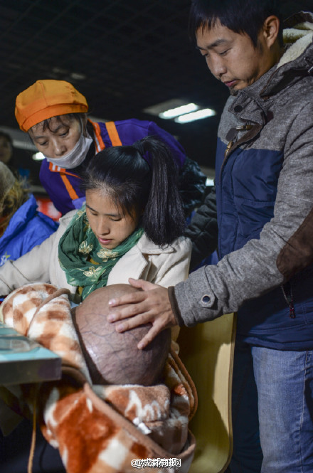 孩子患病成“大头娃娃” 为省钱一家人住车里