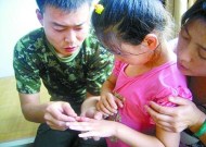 烟台4岁女童手指被卡三轮车链条严重变形 图片默认标题_fororder_u=3172389932,846904003&fm=11&gp=0_副本