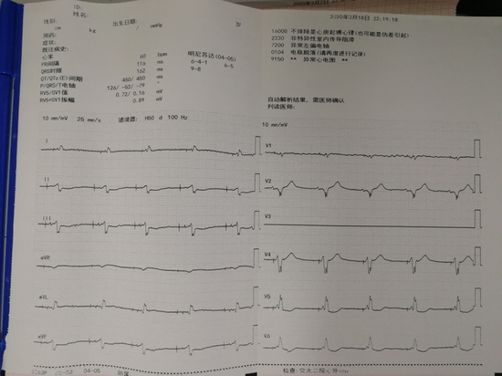 心脏起搏器心电图报告图片