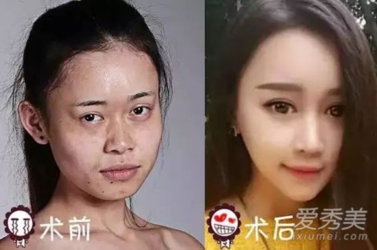 《中国好声音》吴玉青花百万整容变脸Baby