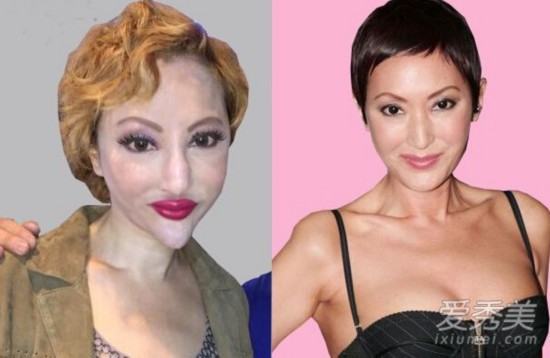 整容失败变怪物?女星薛芷伦自称变脸因抗癌
