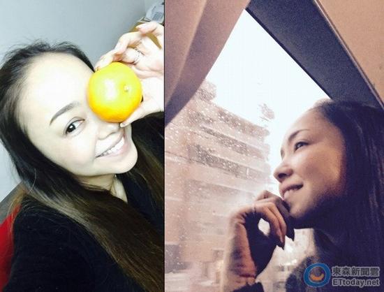 快秃头？安室奈美惠曝近照发际线严重后退