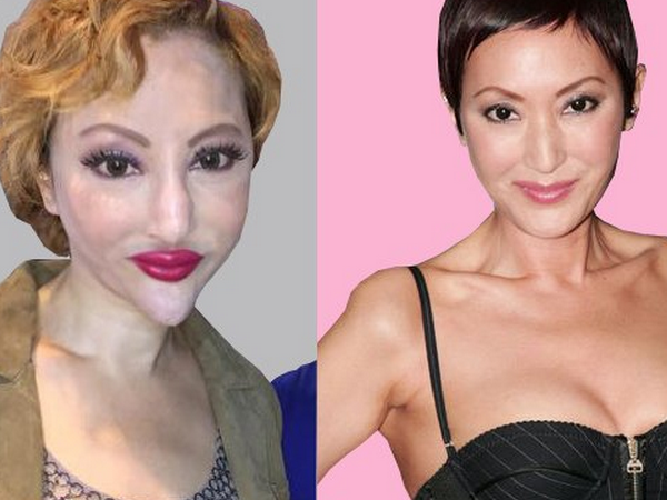 名媛薛芷伦坚称没整容 样貌变化因为抗癌后遗症