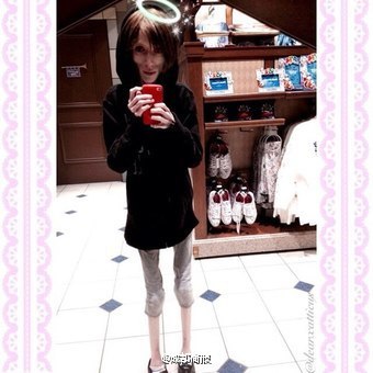 美国极度厌食症少女体重仅36斤:皮包骨似骷髅(组图)