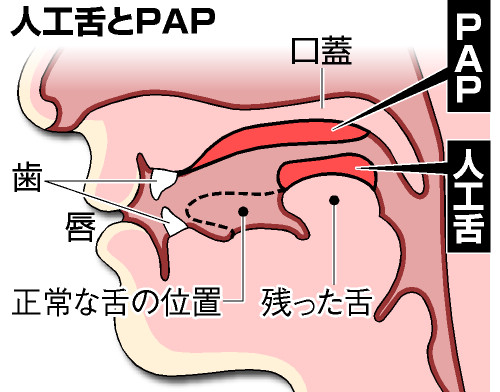 日本研发“人工舌头” 功能全面系全球首例(图)