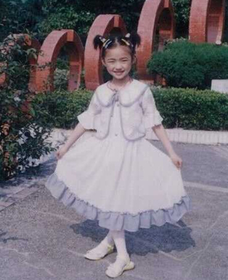 林允整容了吗？林允童年照曝光女大十八变