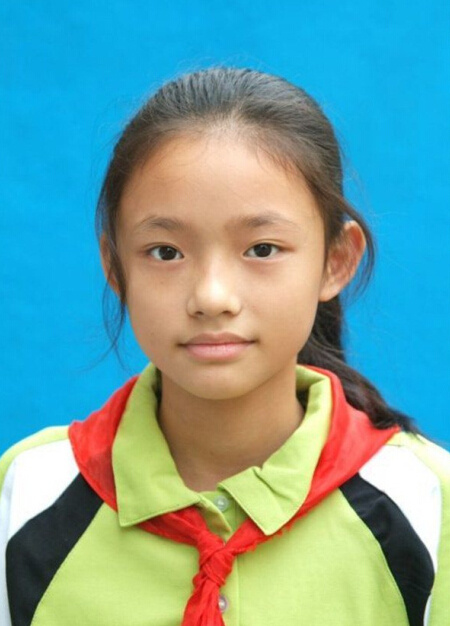 林允整容了吗？林允童年照曝光女大十八变