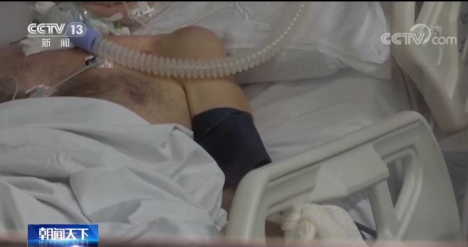 Vaksinasi Hindarkan 40 Ribu Lansia Brasil dari Kematian Akibat Virus Corona_fororder_捕获bx2.JPG