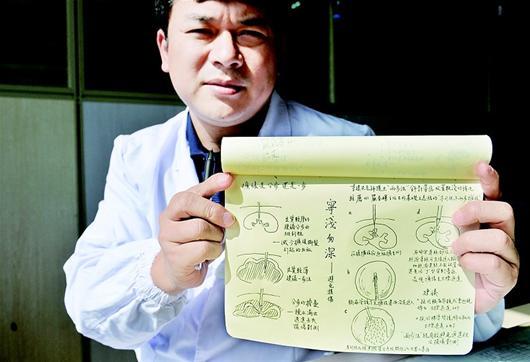 醫生手繪18幅手術“秘籍”走紅 耗時月余