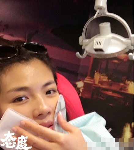 刘涛自曝曾整全口美容牙 捂嘴劝网友没事别换牙