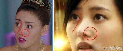 太子妃男友被拍恋情疑曝光 揭张天爱整容对比照