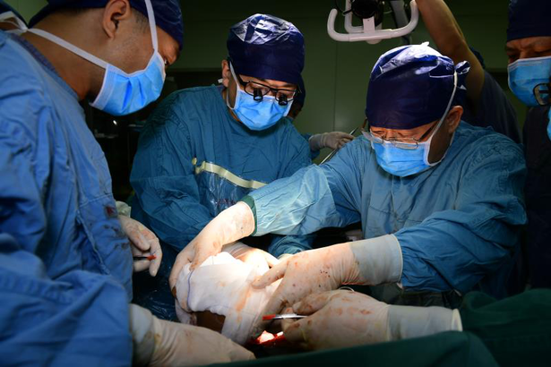 正在做手术的西安交通大学第一附属医院教授吕毅(前排右一) 供图 西安