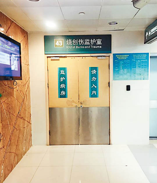 SNH48唐安琪严重烧伤 危在旦夕恐毁容