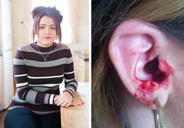 英国女孩患怪病七窍出血 无处可医(组图)