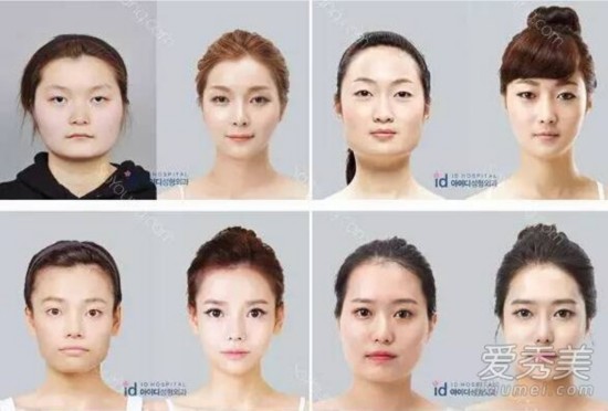 《她很漂亮》男主角朴叙俊整容前样子好土