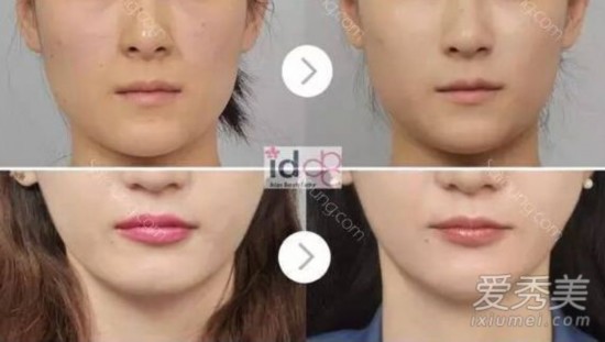 《她很漂亮》男主角朴叙俊整容前样子好土