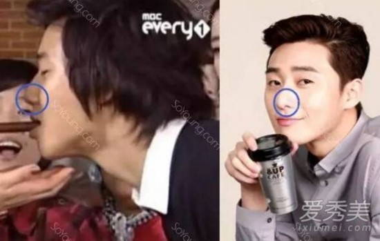 《她很漂亮》男主角朴叙俊整容前样子好土