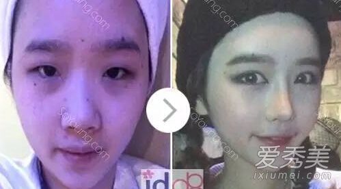 《她很漂亮》男主角朴叙俊整容前样子好土