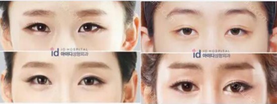 《她很漂亮》男主角朴叙俊整容前样子好土