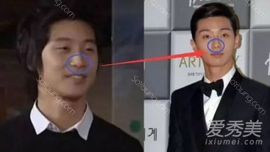 《她很漂亮》男主角朴叙俊整容前样子好土