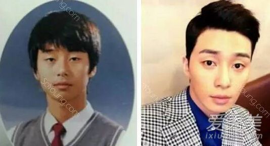 《她很漂亮》男主角朴叙俊整容前样子好土