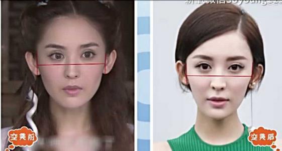 古力娜扎也整容了，脸窄了一大圈，哎！