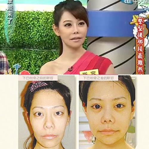 周杰伦娶了个假面女人 昆凌昔日综艺秀塌鼻肿脸