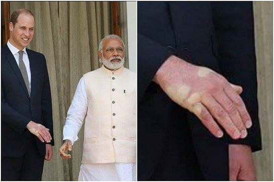 印度总理握手太用力 致威廉王子手上留手印(图)
