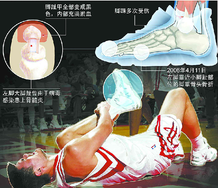 与NBA结缘的中国人:大郅成首人 周琦将接班?