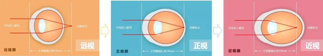 【教育频道】国家儿童医学中心北京儿童医院眼科主任李莉：爱眼护眼 从小抓起