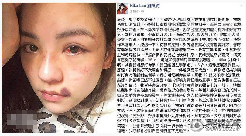 港姐真人格斗秀遭暴打险毁容 宣布退出娱乐圈